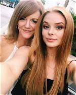 Abigail Cowen Plastic Surgery – Before and After Pictures