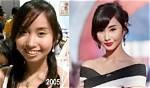 Alodia Gosiengfiao Before Operation and Surgery Photos on Instagram, Fhm Cover Girl Looked Different ·