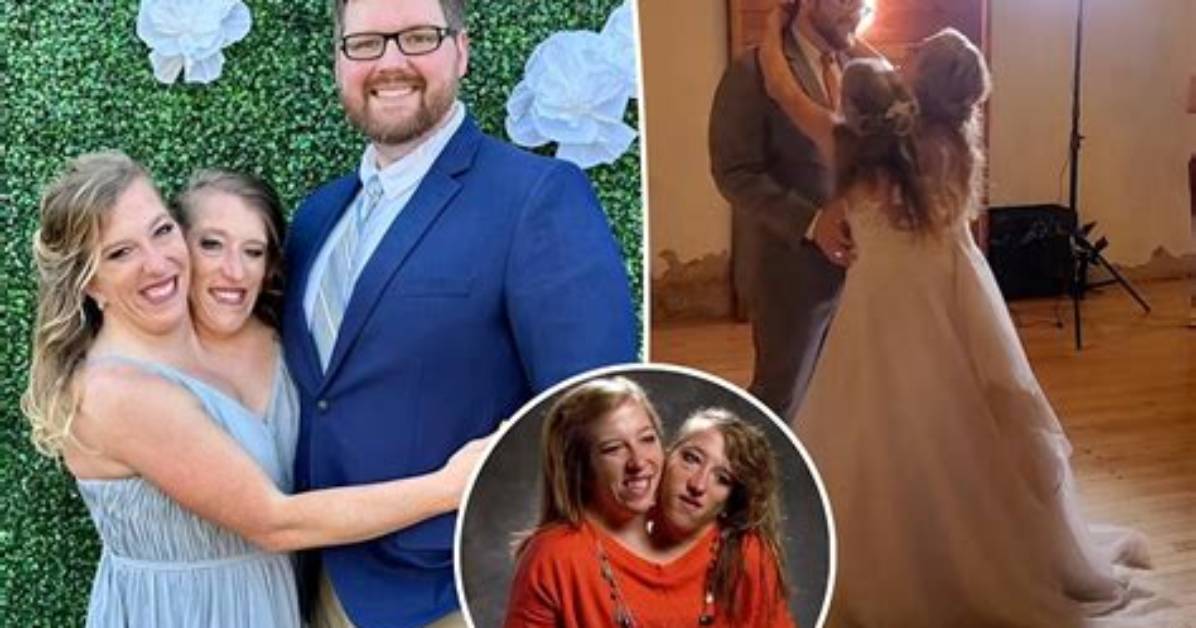 Are Abby and Brittany Hensel Married? Relationship Timeline