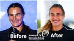 Aryna Sabalenka | Done Plastic Surgery? Before and After