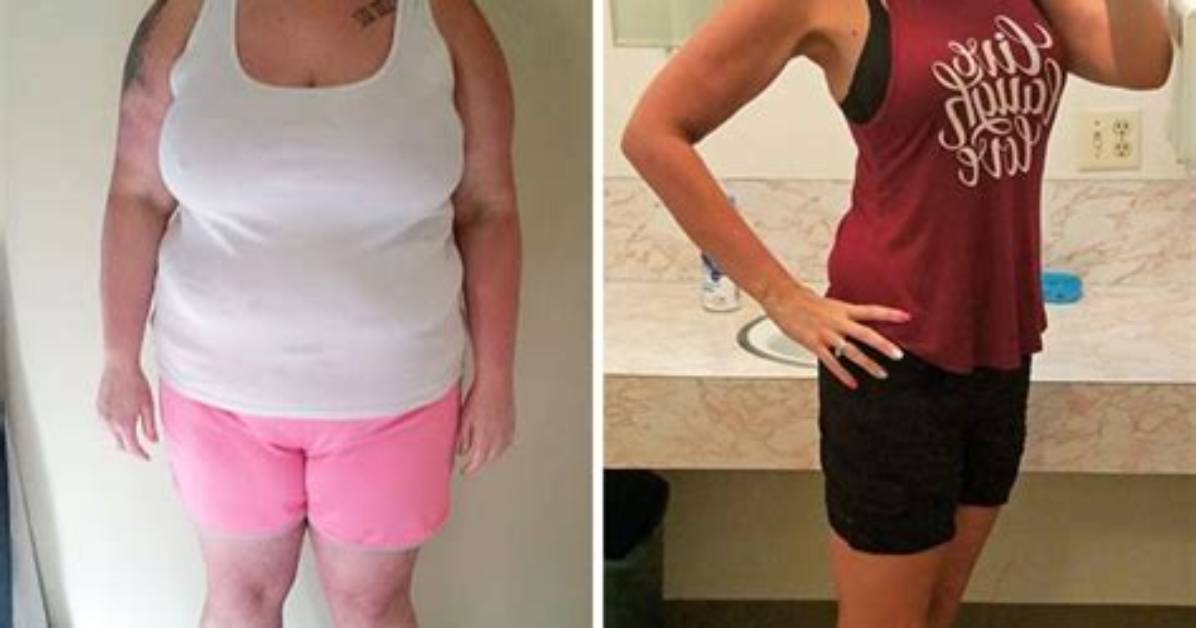 Before & After Plenity Weight Loss Pictures