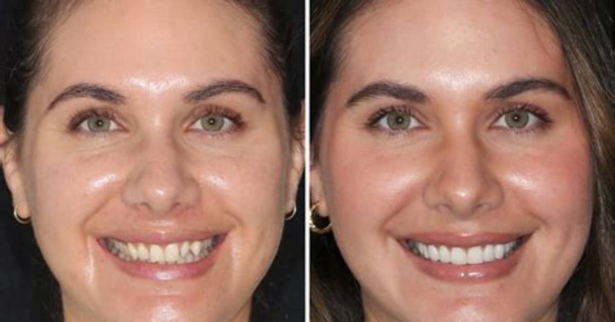 Before and After Photos |