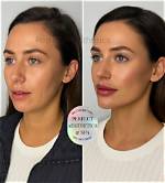 Before and After Pics, Age and Husband