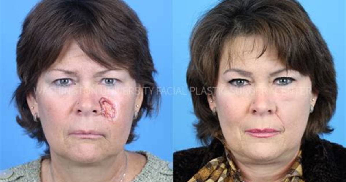 Before and After Plastic Surgery Photos Revealed ·