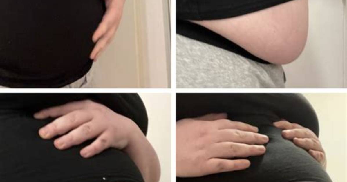Belly Inflation: the Fascinating World of Inflation Fetishism