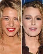 Blake Lively Before and After the Rumoured Nose Job She's Never Admitted to |