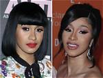 Cardi B Nose Before and After Picture: What Did Cardi B Do to Her Nose?
