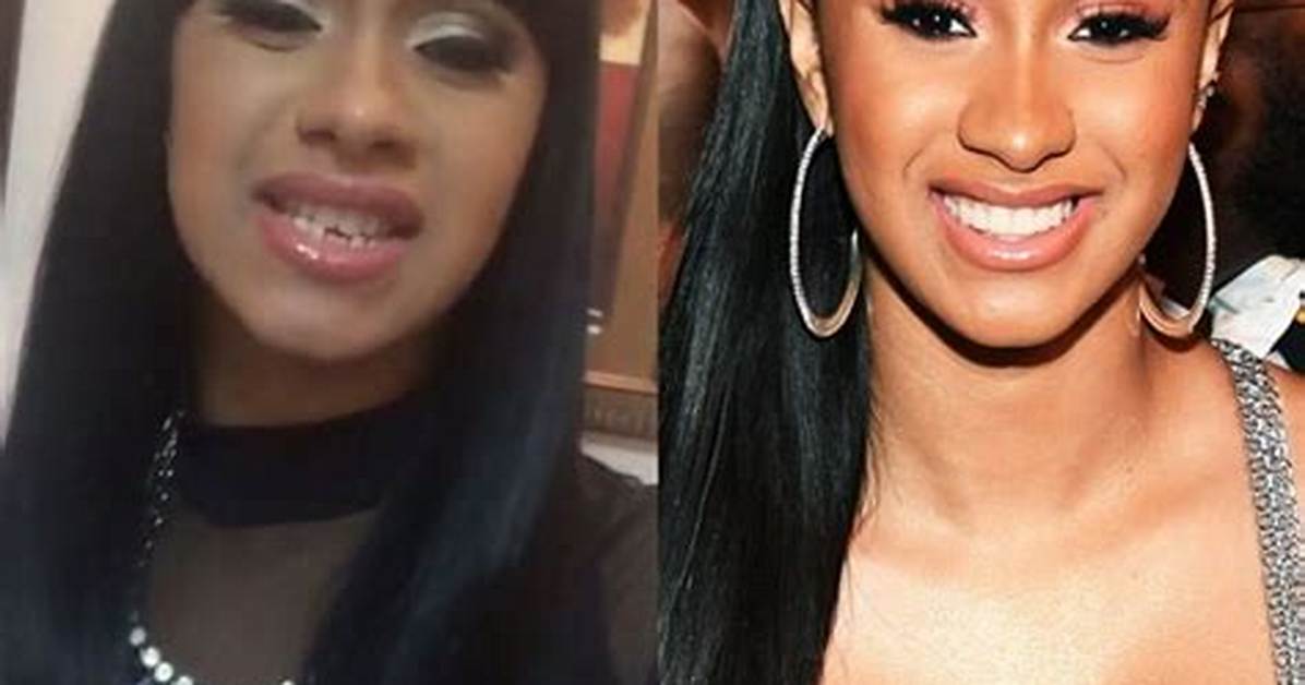 Cardi B’s New Teeth Costs $40K – Before and After Pictures of Smile Makeover | Dr. Catrise Austin Is the Dentist