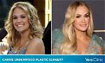 Carrie Underwood Plastic Surgery: Uncovering Hidden Truths