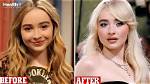 Celebrity Plastic Surgery: Uncovering Sabrina Carpenter's Transformations