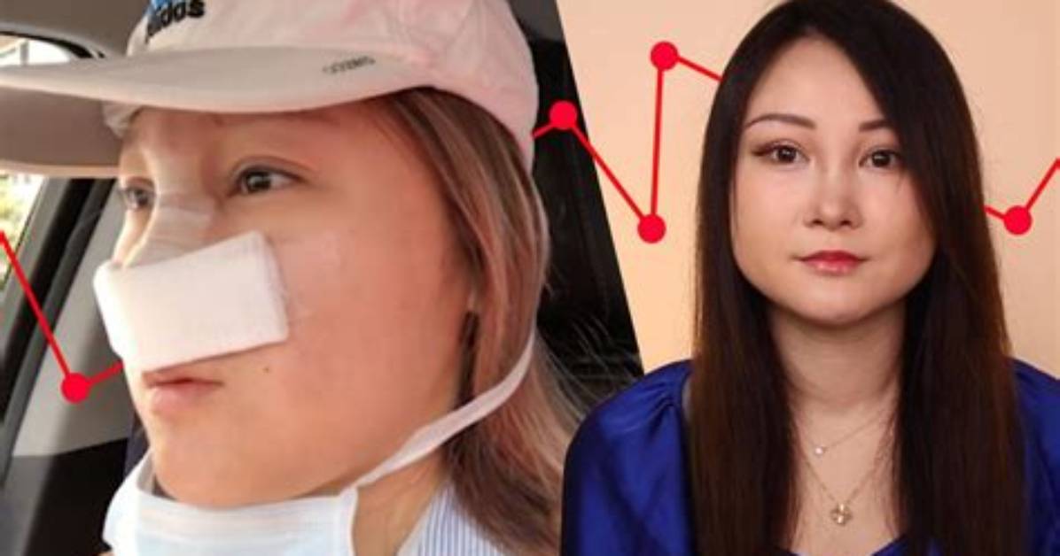 Cherry White Before Surgery Pics, Age Height and Net Worth Revealed
