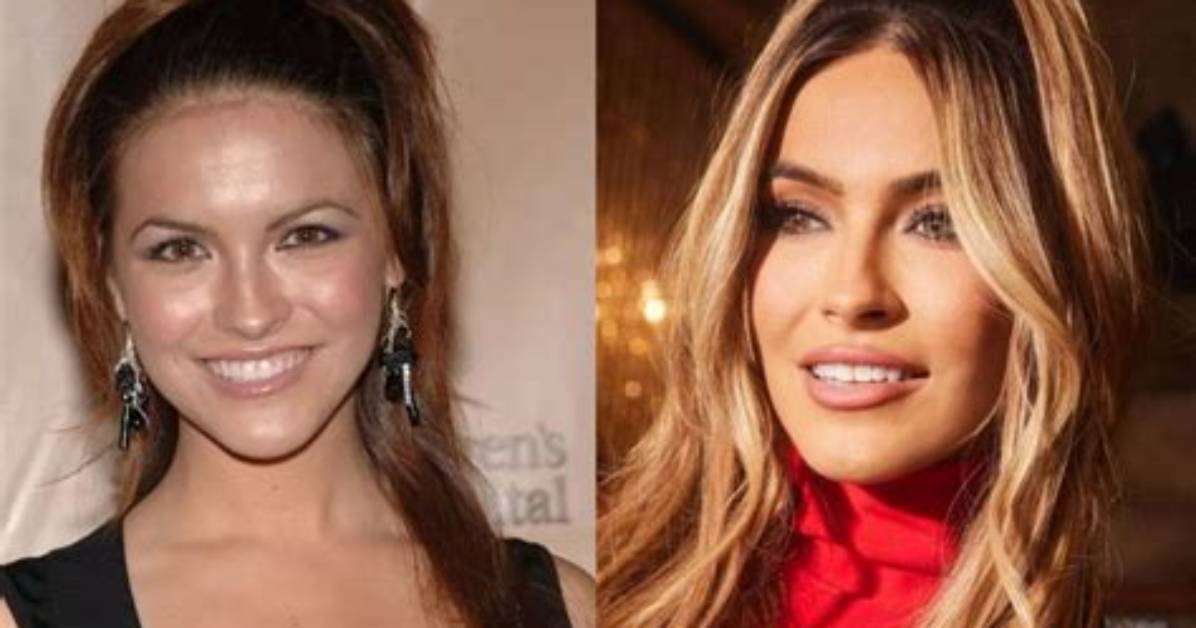 Chrishell Stause Before and After Plastic Surgery: No Makeup Look of the Selling Sunset Alum Examined!