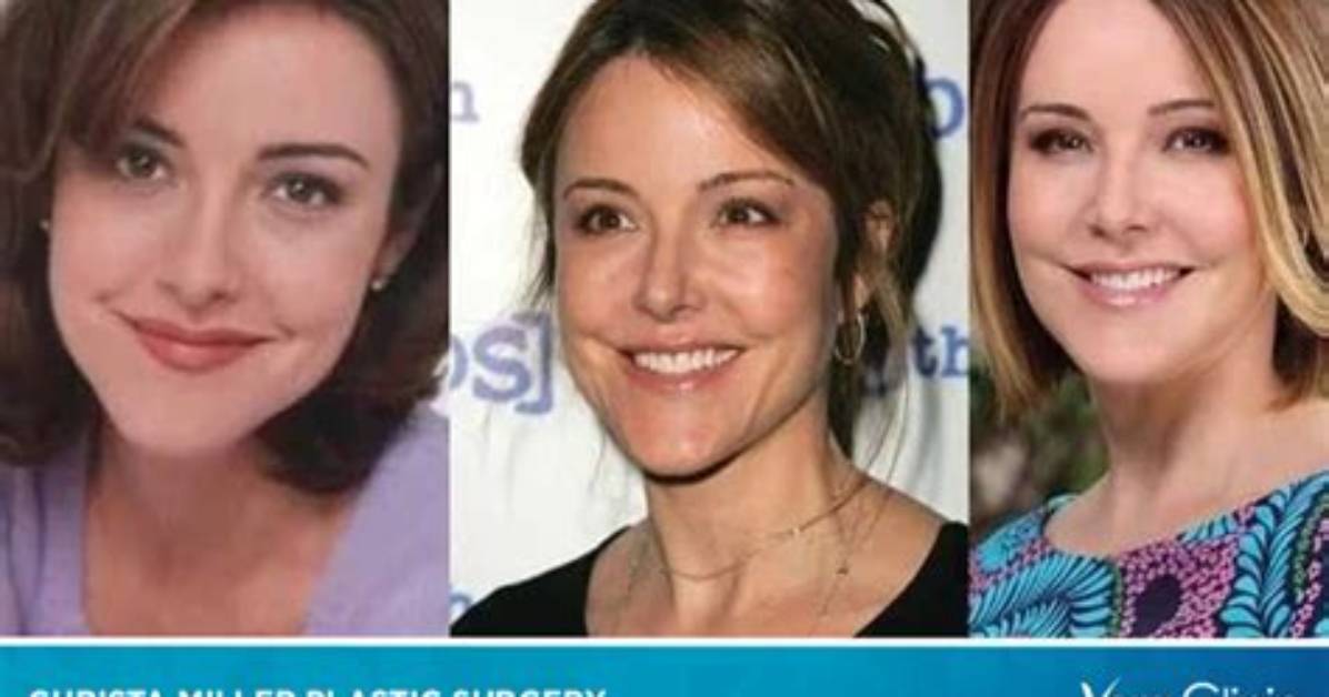 Christa Miller Biography, Plastic Surgery, Net Worth and Family Life