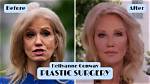 Claudia Conway Plastic Surgery Before and After |