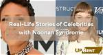 Courage and Resilience: Celebrities with Noonan Syndrome