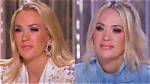 Did Carrie Underwood Get Her Lips Done? Plastic Surgery |