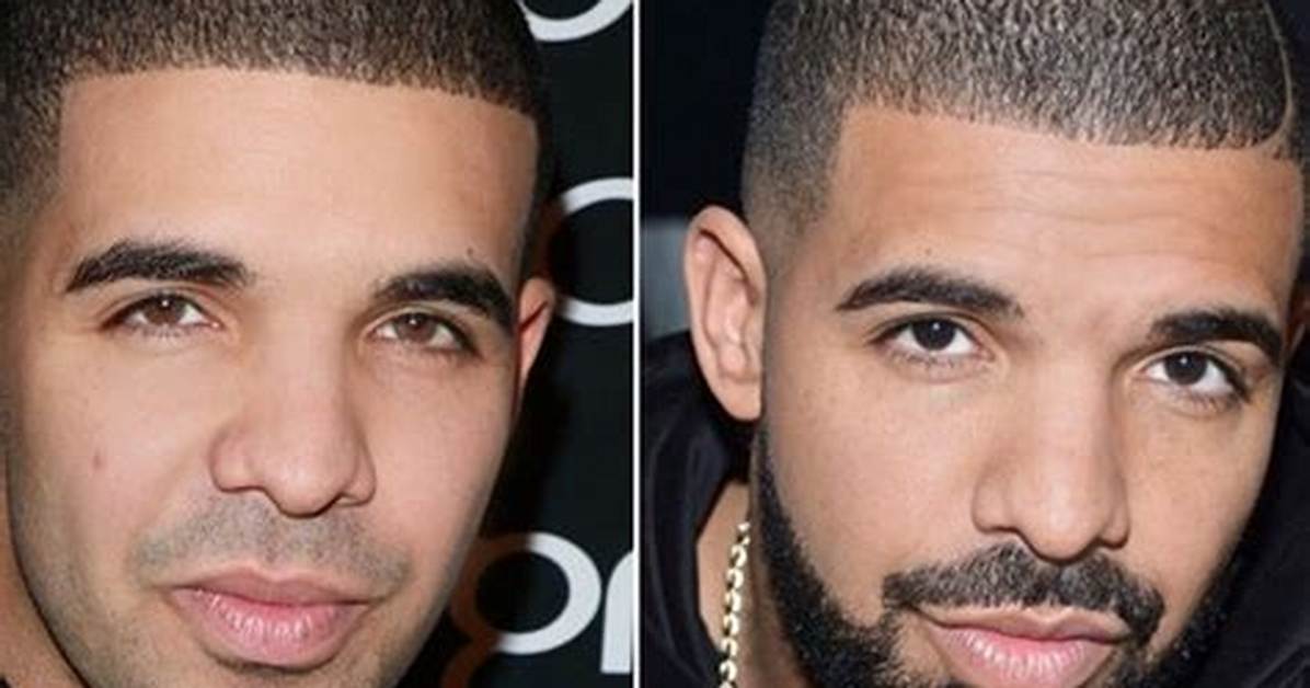 Did Drake Have Plastic Surgery to Get His Abs? Internet Debates ·