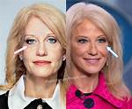Did Kellyanne Conway Get Plastic Surgery? Know Here