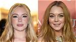 Did Lindsay Lohan's Appearance Transform Through Surgery?