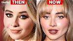Did Sabrina Carpenter's Surgery Really Happen? : Uncovering the Truth
