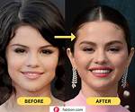Did Selena Gomez Get Plastic Surgery? Exploring the Evidence and Rumors
