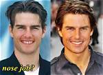 Did Tom Cruise Get a Nose Job?