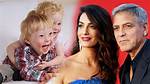 Does Alexander Clooney Have Down Syndrome: the Truth Revealed