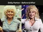 Dolly Parton's Breast Augmentation: the Untold Story