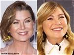 Ellen Pompeo's Journey with Fillers: Before and After Transformation