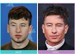 Examining Barry Keoghans Alleged Plastic Surgery! ·