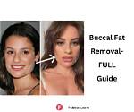 Exploring the Fascination Behind Buccal Fat Removal: the Olsen Twins’ Transformation