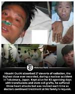 Exploring the Impact of Ouchi Radiation Pictures