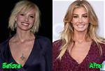 Faith Hill Surgery: an in-Depth Look at the Surgery She Underwent
