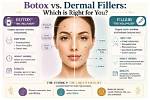 Fillers and Botox to Remain Youthful? |