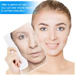 Frownies Patches May Soften Wrinkles Without Botox ·