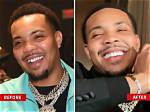 G Herbo Gets New Veneers Before Five-Year Prison Sentence