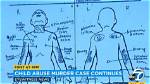 Gabriel Fernandez Crime Scene Photos: Death Cause and Murder Case