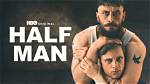 'Half Man' Learns to Walk in China |