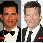 Harry Connick Jr's Stroke in 2019: a Journey of Resilience