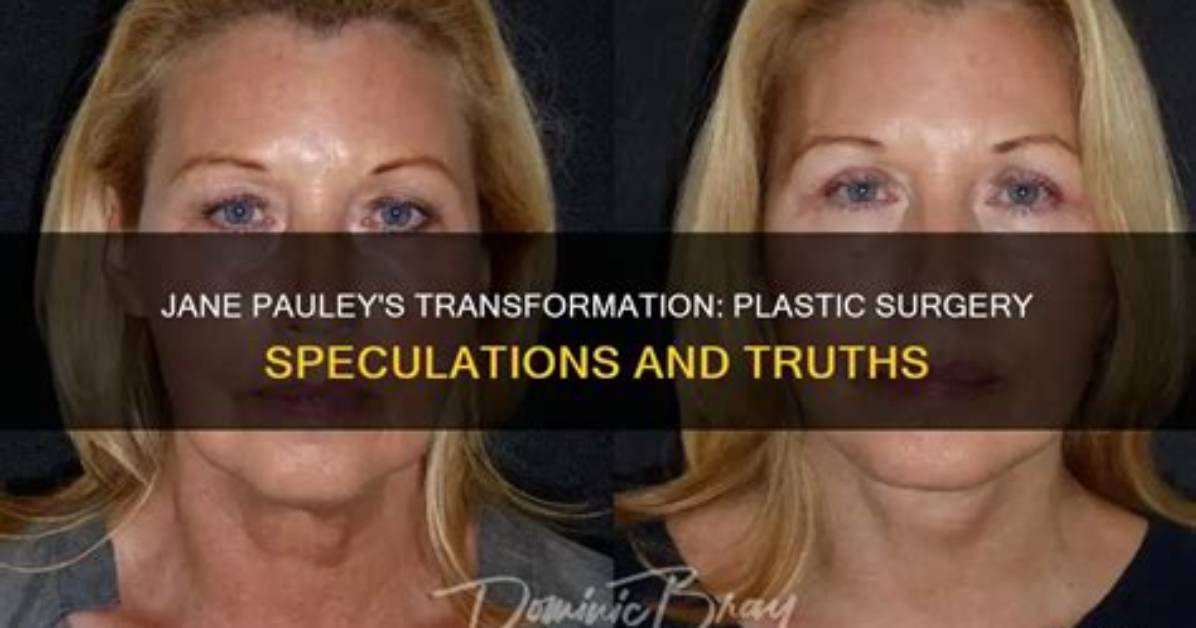Has Jane Pauley Had Plastic Surgery? 71-Year's-Old Cbs Sunday Host Looks So Young for Her Age!
