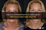 Has Jane Pauley Had Plastic Surgery? 71-Year's-Old Cbs Sunday Host Looks So Young for Her Age!