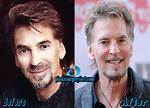 Has Kenny Loggins Had Plastic Surgery? Married Life and His Wives Details