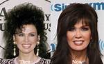 Has Marie Osmond Gotten Plastic Surgery? Our Experts Weigh in!
