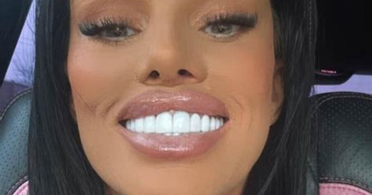 Has Nany Had Her Teeth Done? Truth Behind Appearance Revealed Thu 25 March 2021 ·