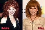 Has Reba Mcentire Had Plastic Surgery? She Says No, the Internet Says Yes ·