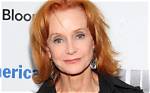 Has Swoosie Kurtz Done Plastic Surgery for Face Lift and Jawline? Her Before and After Photos Explored