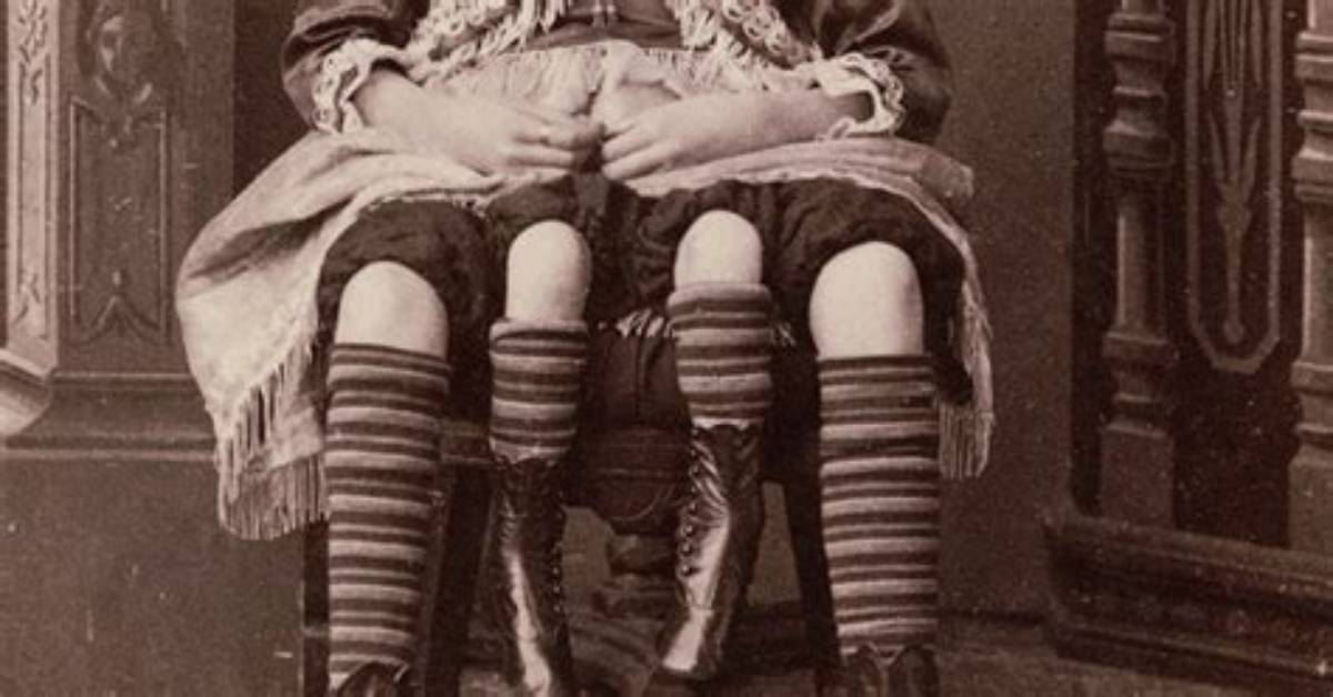 He Was Known as 'The Human Freak': Maurice Tillet's Forgotten Daughter