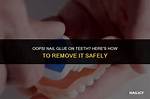 How to Get Nail Glue off Teeth
