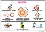 How to Identify and Treat an Infection