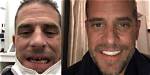 Hunter Biden's Teeth Transformation: a Comprehensive Review
